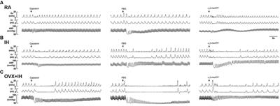 Estrogen Modulates the Sensitivity of Lung Vagal C Fibers in Female Rats Exposed to Intermittent Hypoxia